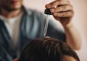 پروکاپیل در مقابل ماینوکسیدیل: کدام برای ریزش مو بهتر است؟