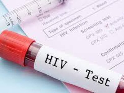 HIV و مکملها: چه نکاتی را باید بدانید؟
