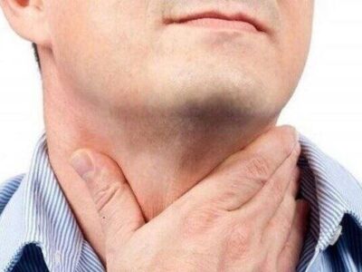 منبع سوزش گلوی مردم مشخص است