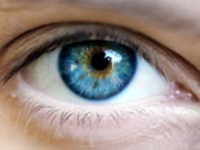 ارائه فرمولاسیون نوین نانویی برای درمان پیرچشمی در مشهد