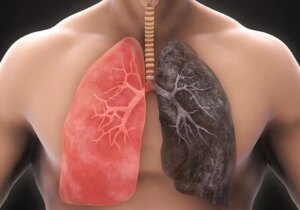 آیا ریه سیگاری‌ها پس از ترک دوباره سالم می‌شود؟