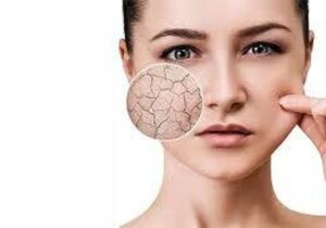 راهنمای کامل سلامت پوست، از روتین روزانه تا مقابله با خشکی و جوش