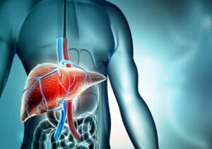 عوامل اصلی رشد سرطان‌های گوارشی در ایران،مصرف الکل و دخانیات متهم شماره یک