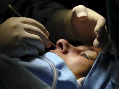 بهای سنگین زیبایی