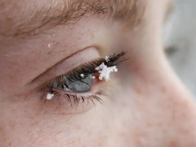 روش های کنترل خشکی چشم در زمستان