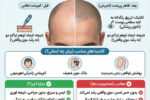 کاشت مو به روش میکرو اسکالپ چیست؟ تحلیل پزشکان شیراز را بخوانید.