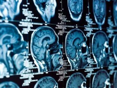 تغییرات اقلیمی و افزایش حملات پانیک در جامعه