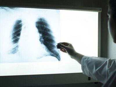 آلودگی هوا و دخانیات؛ دو عامل اصلی تهدیدکننده سلامت ریهها