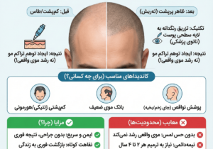 کاشت مو به روش میکرو اسکالپ چیست؟ تحلیل پزشکان شیراز را بخوانید