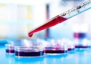 خون پیر مغز را آلزایمری میکند!