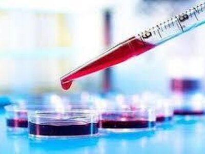 خون پیر مغز را آلزایمری میکند!