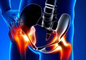 چرا برخی دردهای لگنی هرگز نباید نادیده گرفته شوند؟