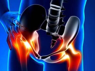 چرا برخی دردهای لگنی هرگز نباید نادیده گرفته شوند؟