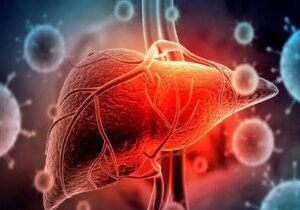 کبد چرب؛ بیماری خاموش قرن کمتحرکی