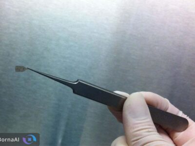 ایمپلنت ریز سلولی؛ امید تازه برای بازگرداندن بینایی بیماران مبتلا به تحلیل لکهای