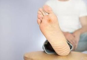 بی‌دردی زخم در افراد دیابتی نشانه چیست؟