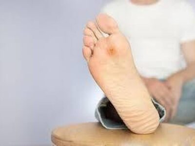 بی‌دردی زخم در افراد دیابتی نشانه چیست؟