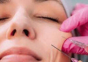 هشدار مهم درباره  ژل‌های تزریقی زیبایی