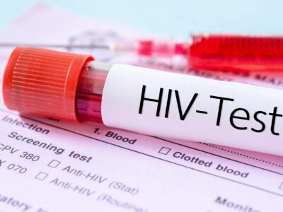 چه کسانی باید آزمایش «ایدز» بدهند