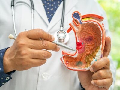 نقش پنهان آلودگی هوا در افزایش خطر بک نوع سرطان