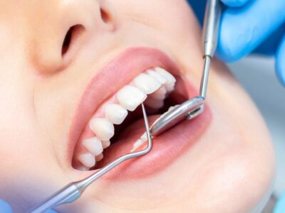 نوبت جرمگیری دندانها را فراموش کردید؟ خطرات پنهان جدیتر از چیزی هستند که فکرش را میکنید