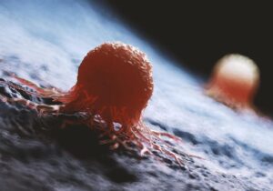 غذاهایی که خطر ابتلا به سرطان را افزایش میدهند