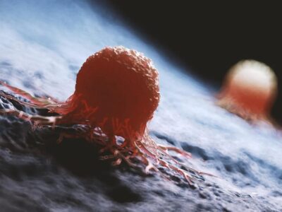 هوش مصنوعی معمای صد ساله سرطان را حل کرد