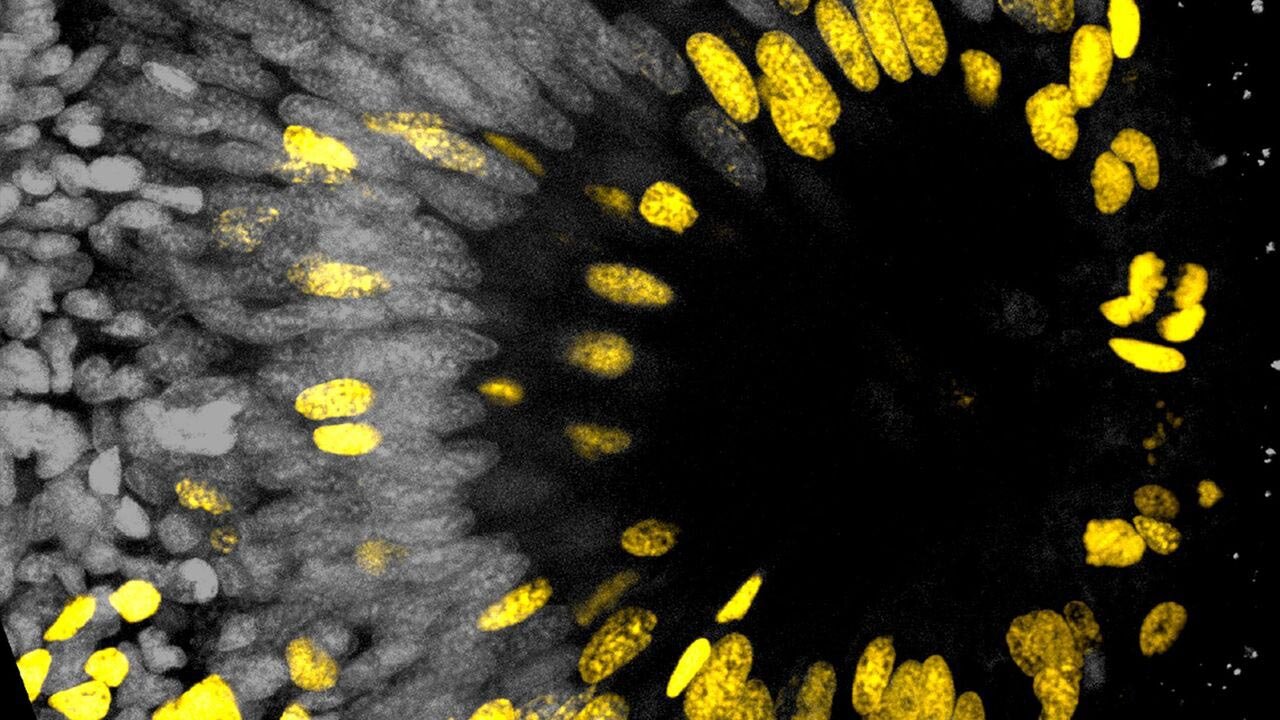 چشمی که هرگز پیر نمیشود