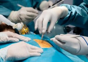 فریب لاغری با بستن رگ اشتها را نخورید؛ این افراد باید با اسلیو و بایپس خداحافظی کنند