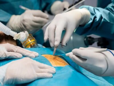 فریب لاغری با بستن رگ اشتها را نخورید؛ این افراد باید با اسلیو و بایپس خداحافظی کنند