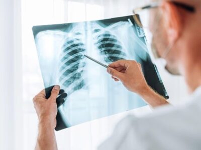 چرا آنفلوآنزا گاهی کشنده می‌شود؟