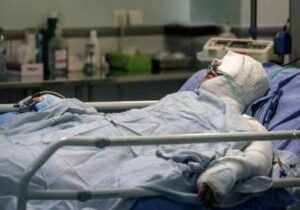 اعلام آمار سالانه سوختگی در ایران/ چند نفر از مصدومان فوت میشوند؟