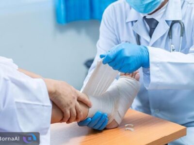 درمان زخم‌های مزمن با پانسمان ایرانی