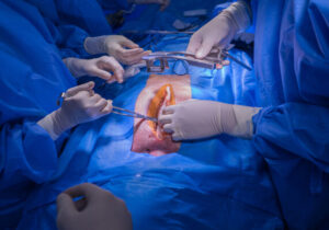 پیوند موفق قلب به دختر ۱۸ ساله در مشهد